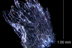 infrastaminal scale