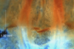 infrastaminal scales