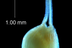 gynoecium