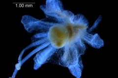 gynoecium with calyx