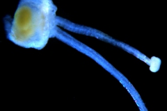 gynoecium