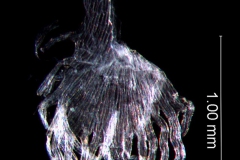 infrastaminal scale