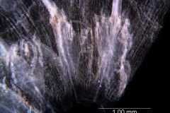 infrastaminal scale detail