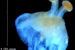 ovary