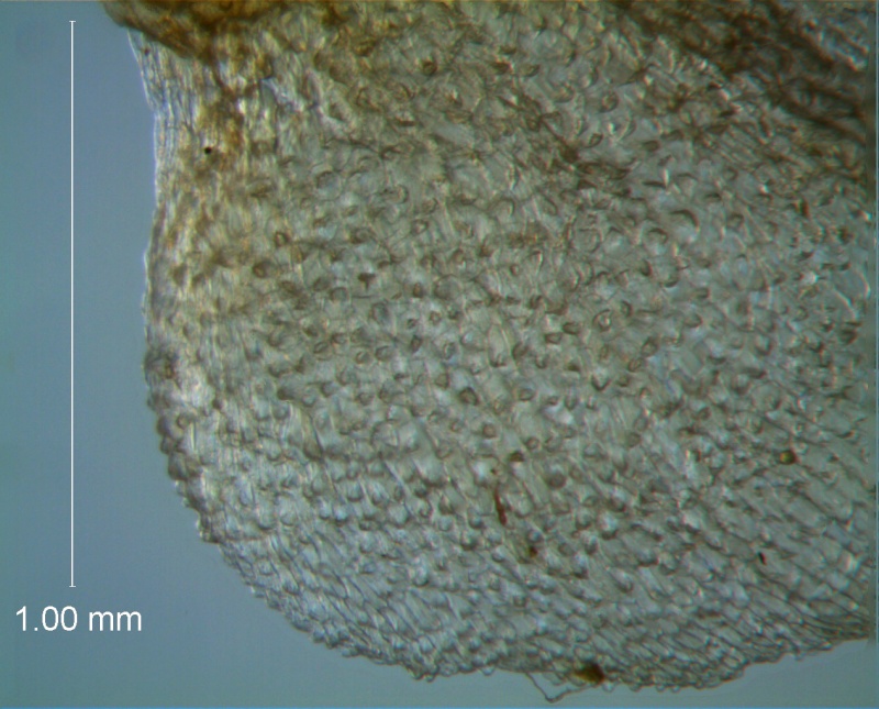 Cuscuta ortegana, papillae on calyx