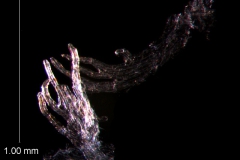 infrastaminal scales