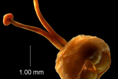 ovary