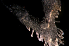 infrastaminal scale