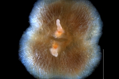 ovary