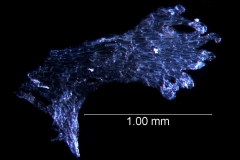 infrastaminal scale