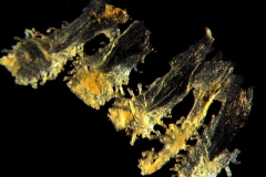 infrastaminal scales