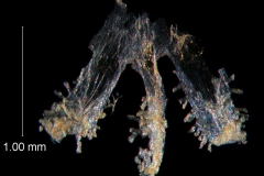 infrastaminal scales