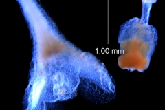 calyx and ovary