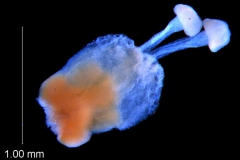 ovary