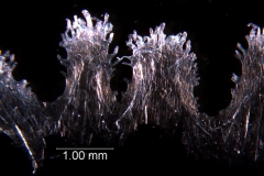 infrastaminal scales