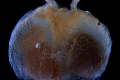 ovary