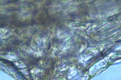 zoom in on raised stomata on calyx