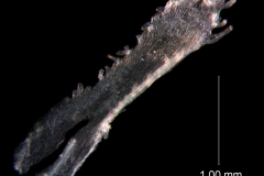 infrastaminal scale