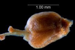 ovary