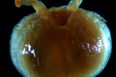 ovary