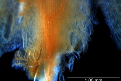 infrastaminal scale