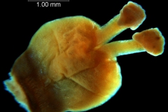 ovary