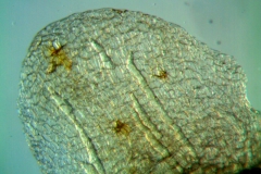 Cuscuta australis, calyx lobe