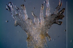 Cuscuta australis var. cesatiana; scale