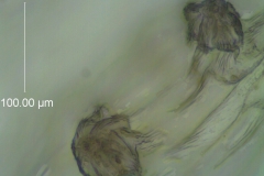 Cuscuta desmouliniana; calyx: protuberances with stomata