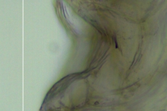 Cuscuta desmouliniana; calyx: protuberances with stomata