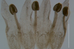 Cuscuta liliputana, dissected corolla