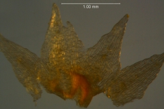 Cuscuta liliputana, dissected calyx