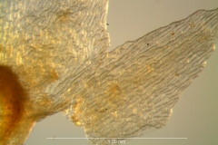 Cuscuta liliputana, dissected calyx