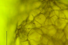 Cuscuta tuberculata, protuberances with stomata on the calyx