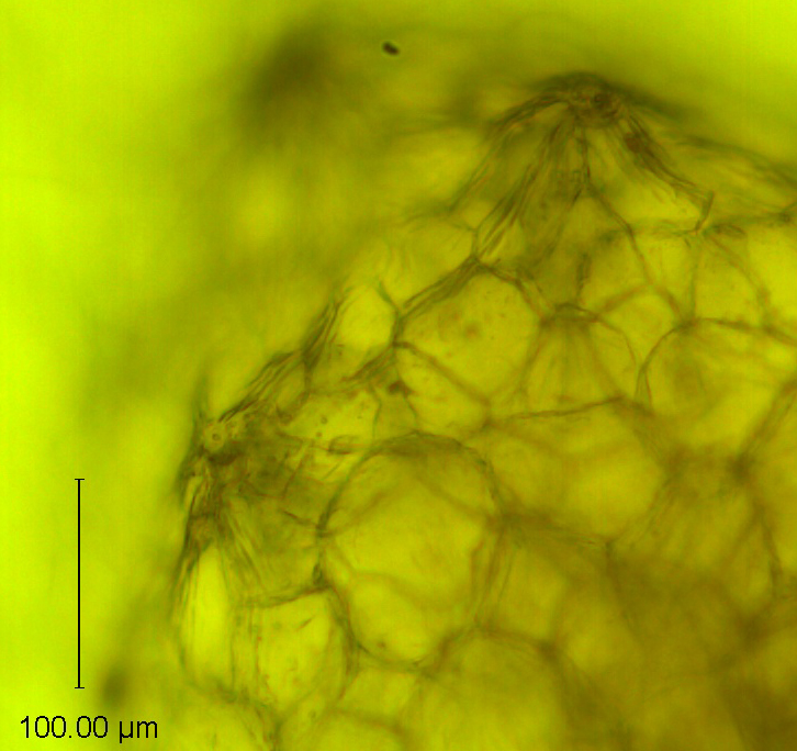 Cuscuta tuberculata, protuberances with stomata on the calyx