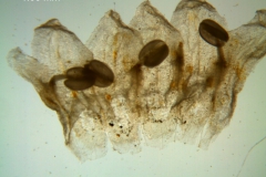 Cuscuta triumvirati, corolla dissected