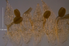 Cuscuta umbellata Kunth, var. umbellata; corolla, dissected