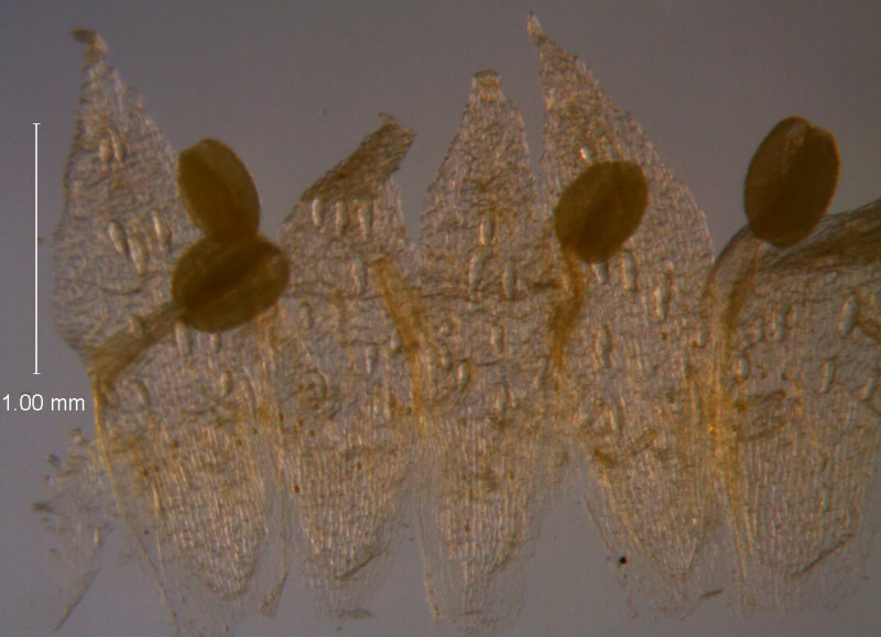 Cuscuta umbellata Kunth, var. umbellata; corolla, dissected