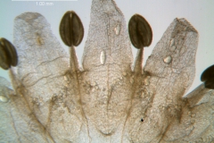 Cuscuta umbellata var. umbellata, corolla - dissected
