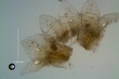 Cuscuta umbellata var. umbellata, calyx - dissected