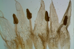 Cuscuta legitima, corolla dissected