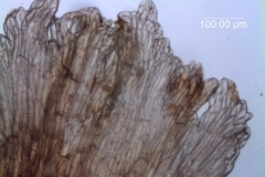 Cuscuta carnosa, infrastaminal scales detail