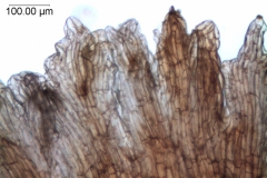 Cuscuta carnosa, infrastaminal scales detail
