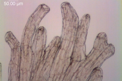 Cuscuta chapalana, infrastaminal scale detail