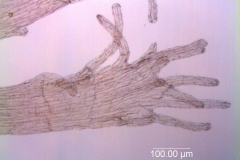 Cuscuta chapalana, infrastaminal scale detail