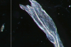 Cuscuta chapalana, detail infrastaminal scale