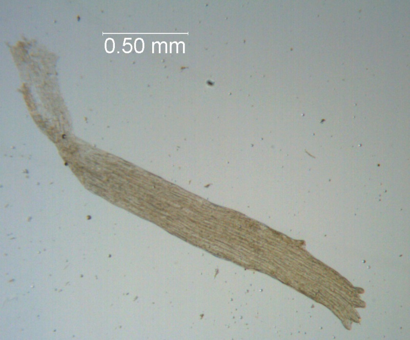 Cuscuta chapalana, infrastaminal scale detail