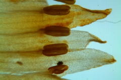 Cuscuta chapalana, corolla lobes