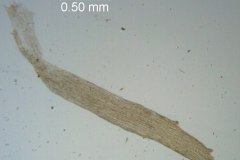 Cuscuta chapalana, infrastaminal scale detail