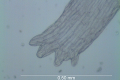Cuscuta chapalana, infrastaminal scale detail